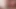 Kızıl ateşli mastürbasyon