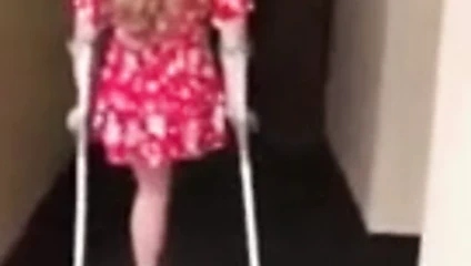 Yüksek topuklu kalça ampute