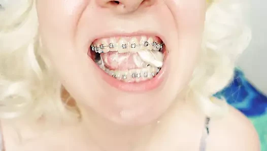 Diş telleri fetiş: yakın çekim video mukbang ...