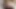 Bölüm 66 : Kayıp iddia için revanche