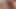 Amarotic Ultimate 567
