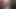 Sexydickman bölüm 18
