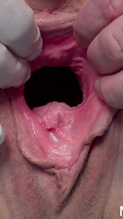 Захватывающий момент из "Медицинского осмотра обнаженной пожилой женщины"