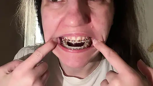 Dilinizle diş teli yalamak