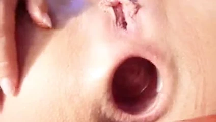 Anal dove sprey kapak