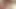 Taylor zayıflama takıntısı sc1
