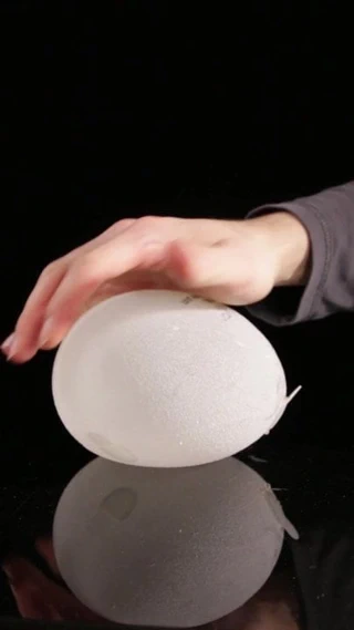 Dolgu meme implantları