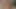 bir teaser