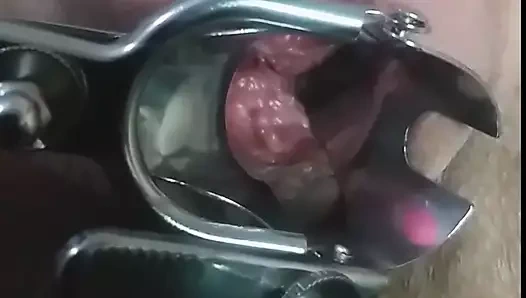 Azgın müfettiş: evde kedi spekulum!