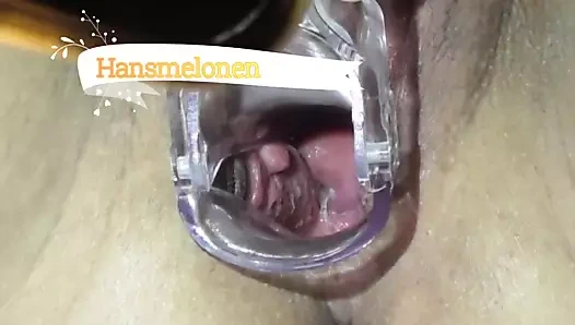 Jinekolog ve servikal oyun