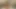 Woman Has Three Breasts and Penis