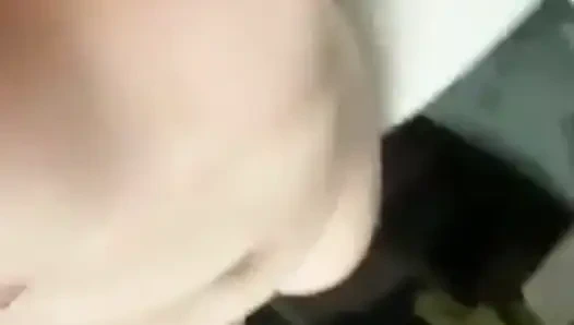 Ampute kız vücudunu gösteriyor