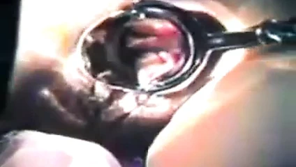 Zhangjiajing hemşireler hizmetçi yapay penis Tayvan Tayvanlı(001