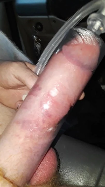 Pompa