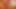 Intimate View of My Mouth