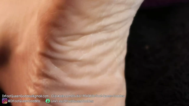 Pedi yumurta pedikür portakal) bölüm 2