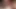 Penis pompası part2 26.02.2019