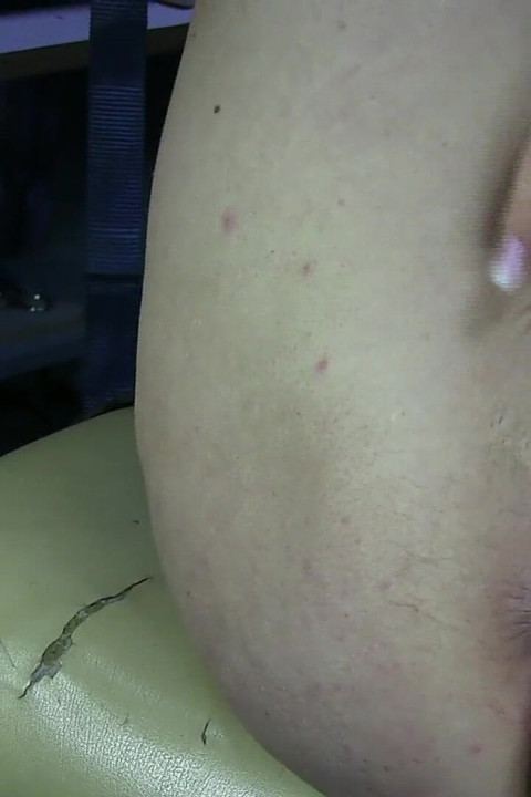 Labia Yayılması Yakın Çekim 2