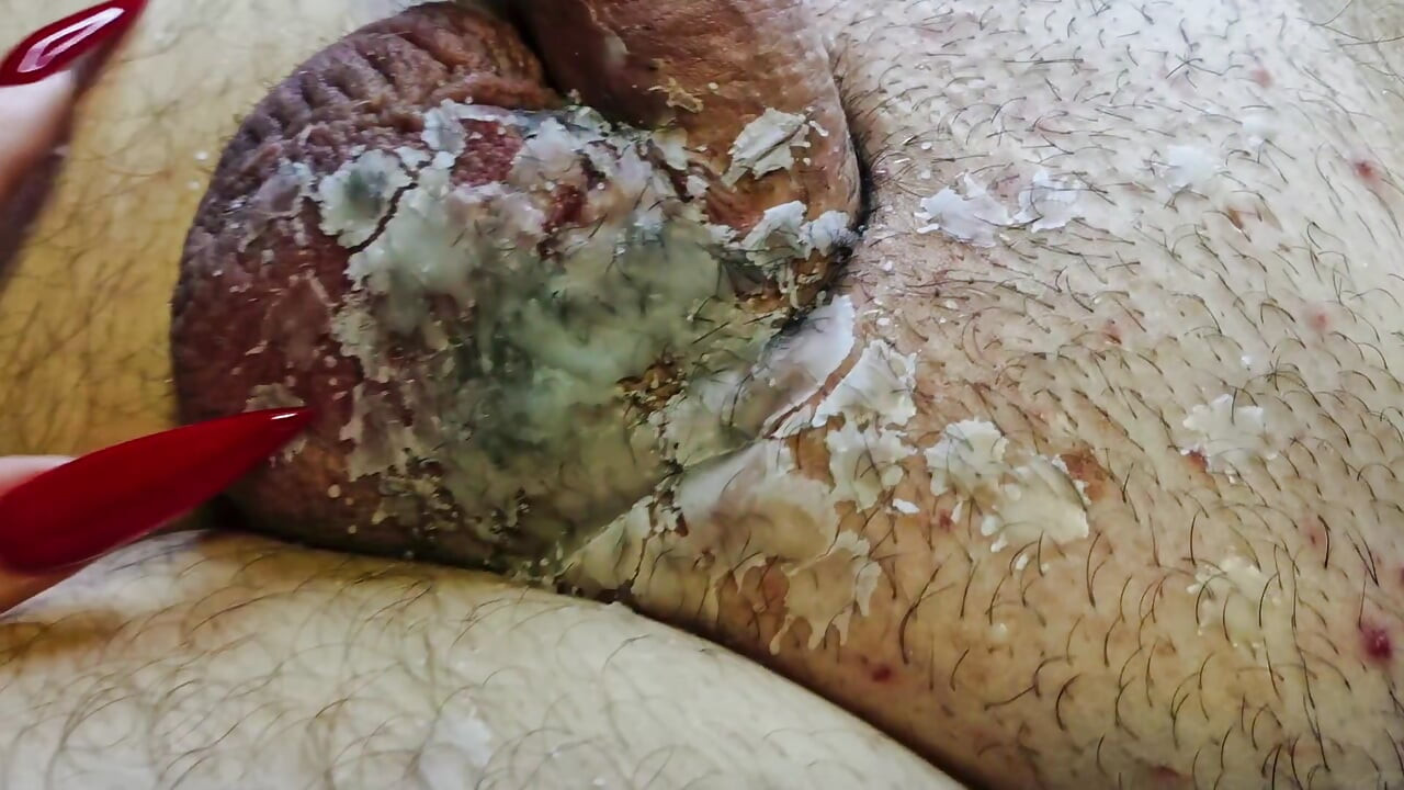 Ateşli mum ağdası cömertçe BDSM kölesinin taşaklarına ve yarağına dökülür. Erkek cinsel organlar için cbt ağda oyunu