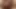 Maça kabarcık popo kraliçesi anal