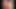 Maitland ward siyah g-string külot vajina dudaklarını gösterir