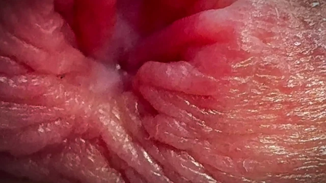 Мочеиспускание на яички