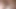 anal2