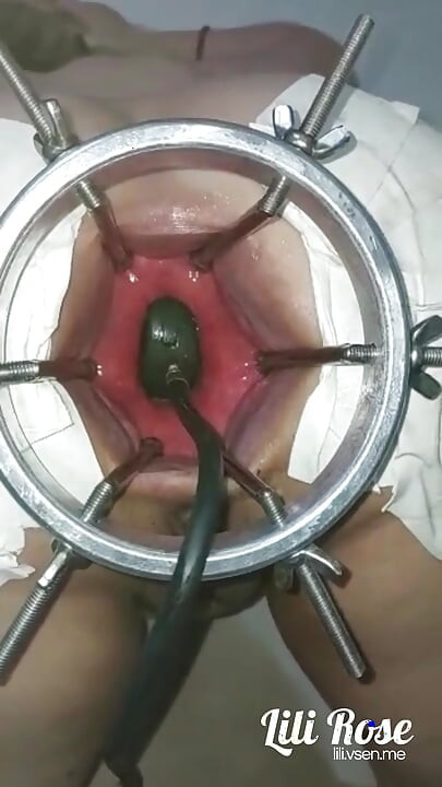 Büyük dildoyu kırık götüme sokuyorum