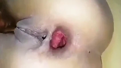 anal çöker
