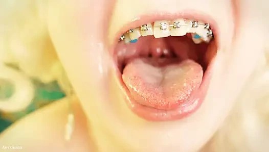 Diş tellerinde yemek - vore ve yemek fetişi - videoyu kapat