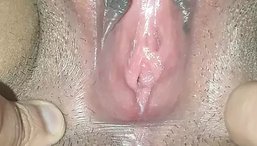 Çatlağı yaymak çünkü neden olmasın...