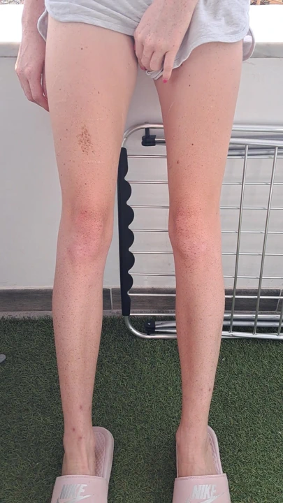 Güneşlenmek için yeni bir bikiniye ihtiyacım var