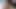 Katheter, Masturbator und Orgasmus