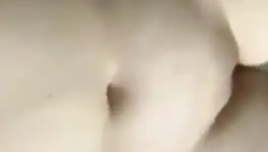 Ampute kız vücudunu gösteriyor