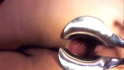Webcam girl dildo and speculum in asshole by M.D.F