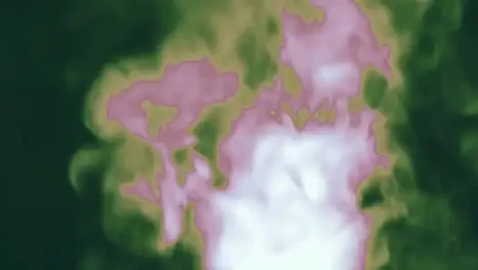 Bekaret inhalanları anal