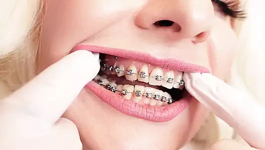 Asmr videosu: sıcak diş telleri ve çift katmanlı tıbbi hemşire nitril eldivenleri (arya grander)