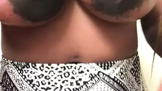 Büyük hamile areolalar