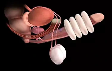 El masajı röntgen tarayıcısı ilk kez
