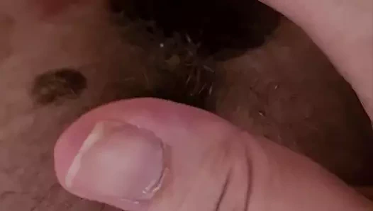 Eğitim ve fms dilatör 54mm ile kıllı amımı germe