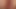 anal 002