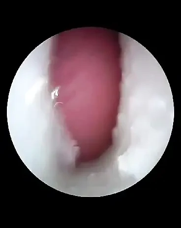 Inside a deflowered 18+ year old hairy cunt.