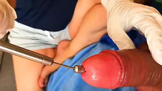 Karım mesaneme uzun bir üretra zinciri yerleştiriyor