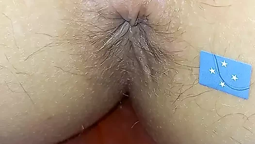 Anal Micronesia