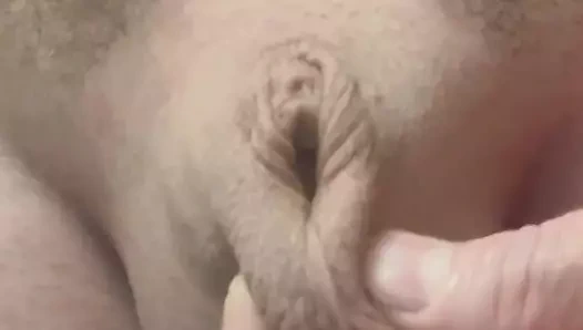 Adam kedi ters mikropenis