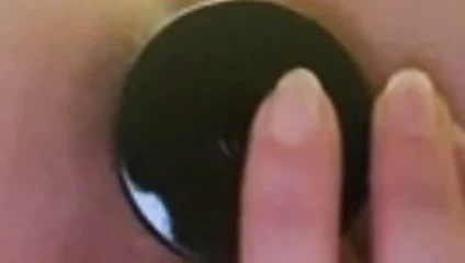 Anal fişin çıkarılması