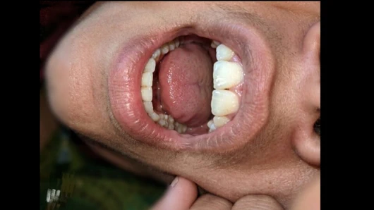 Geceleri Battisi'nin karısına ve xxx'ine bir video gösterdi