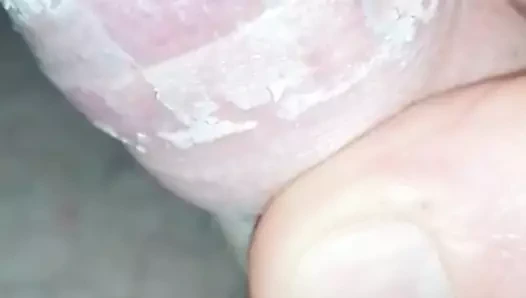 Smegma sebo cheese musky