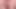 Benimki Çok Yakın