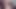 amatör fisting - büyük el